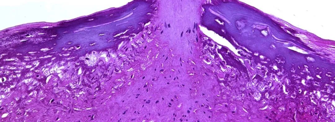 动脉钳怎么用动脉重度钙化导丝无法通过 针具技术超补救策略_https://www.jmylbn.com_新闻资讯_第29张