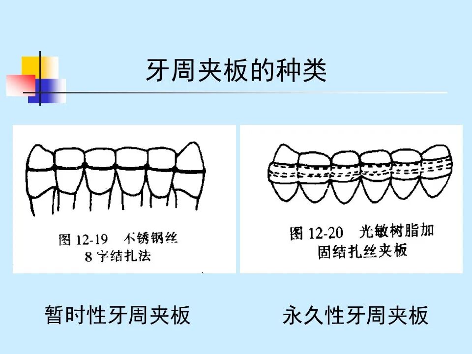 不得不知的治疗牙周炎的5种最有效方法！