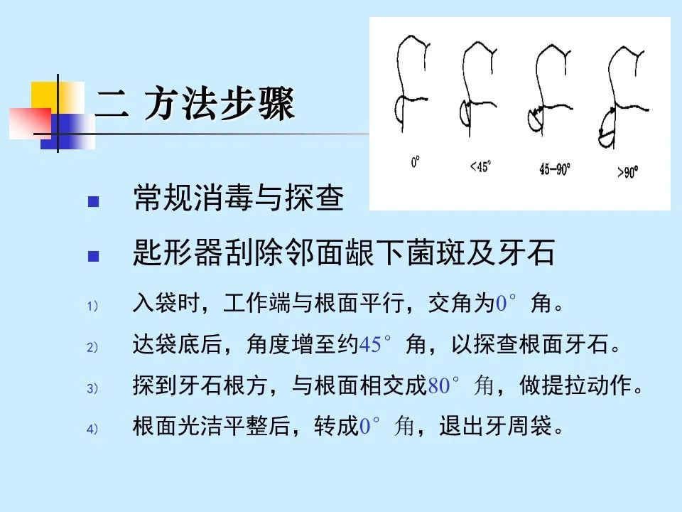不得不知的治疗牙周炎的5种最有效方法！