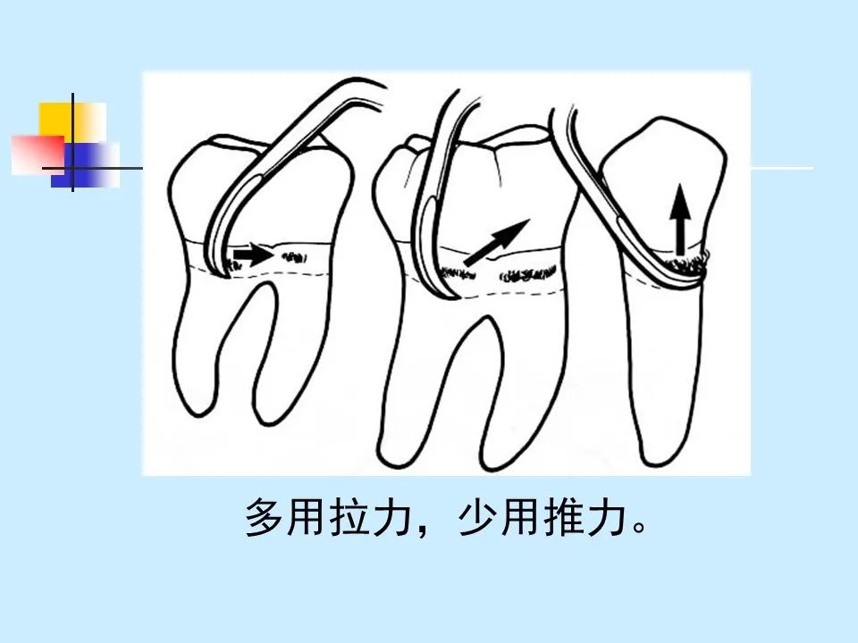 不得不知的治疗牙周炎的5种最有效方法！