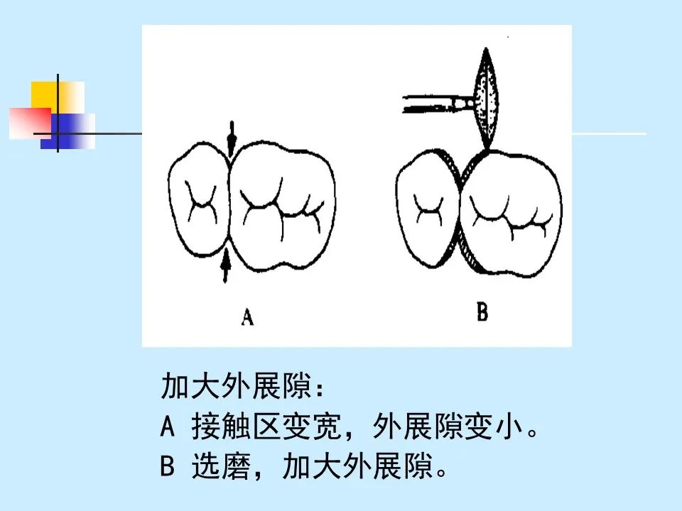 不得不知的治疗牙周炎的5种最有效方法！