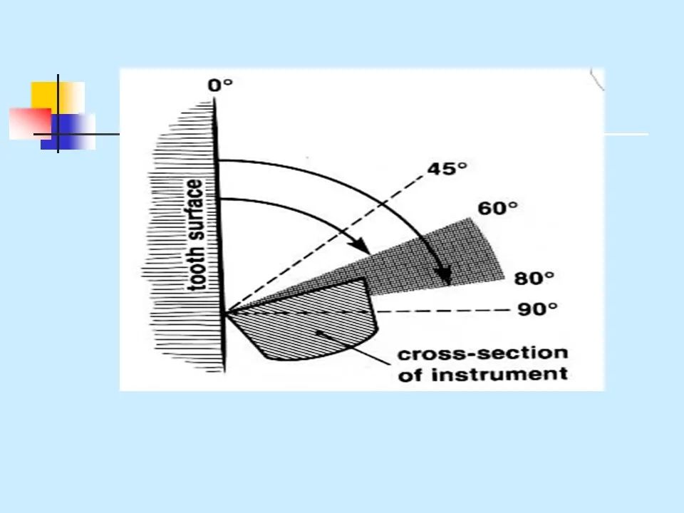 不得不知的治疗牙周炎的5种最有效方法！