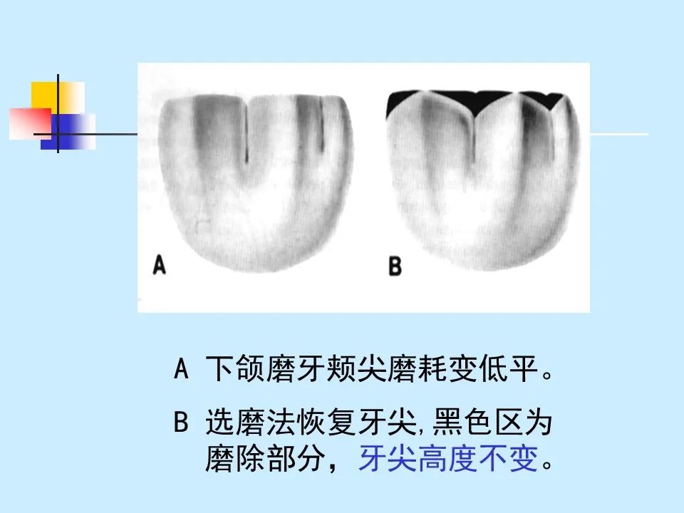 不得不知的治疗牙周炎的5种最有效方法！
