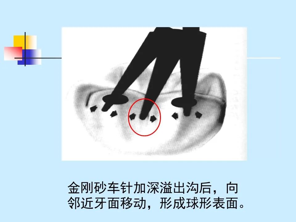 不得不知的治疗牙周炎的5种最有效方法！