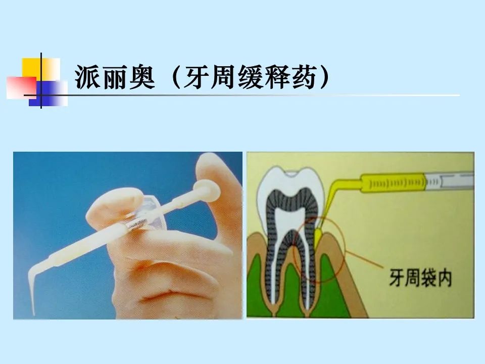 不得不知的治疗牙周炎的5种最有效方法！