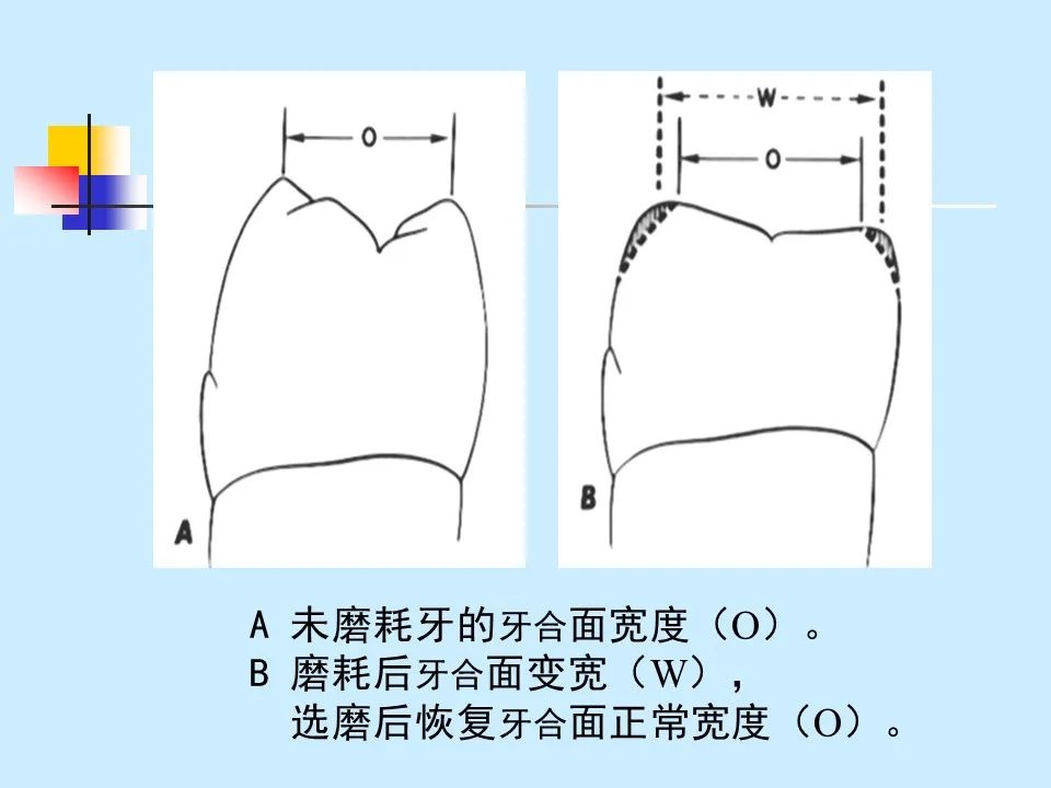 不得不知的治疗牙周炎的5种最有效方法！