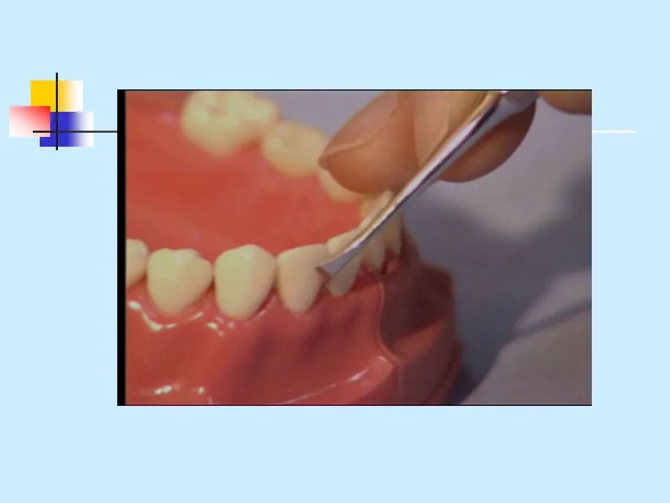不得不知的治疗牙周炎的5种最有效方法！