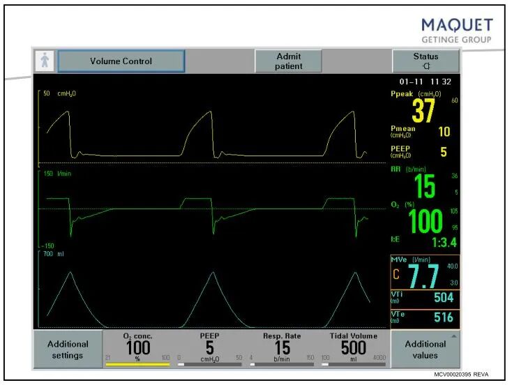 家用呼吸机怎么调节「基础篇」呼吸机模式及参数设置_https://www.jmylbn.com_新闻资讯_第7张