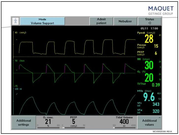 呼吸机呼吸用什么表示「基础篇」呼吸机模式及参数设置，快速上手！呼吸机操作入门，看这篇就够了_https://www.jmylbn.com_新闻资讯_第14张