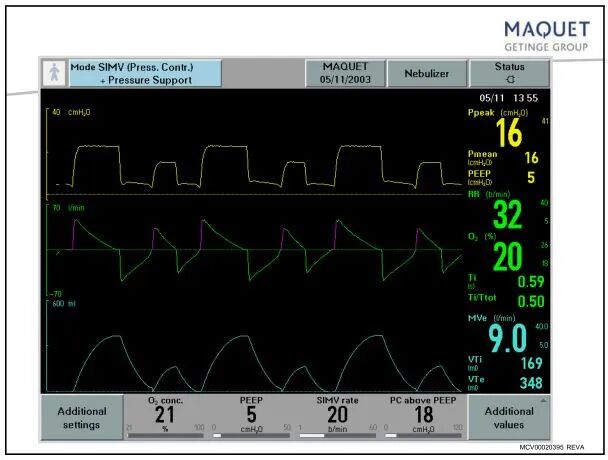 家用呼吸机怎么调节「基础篇」呼吸机模式及参数设置_https://www.jmylbn.com_新闻资讯_第18张
