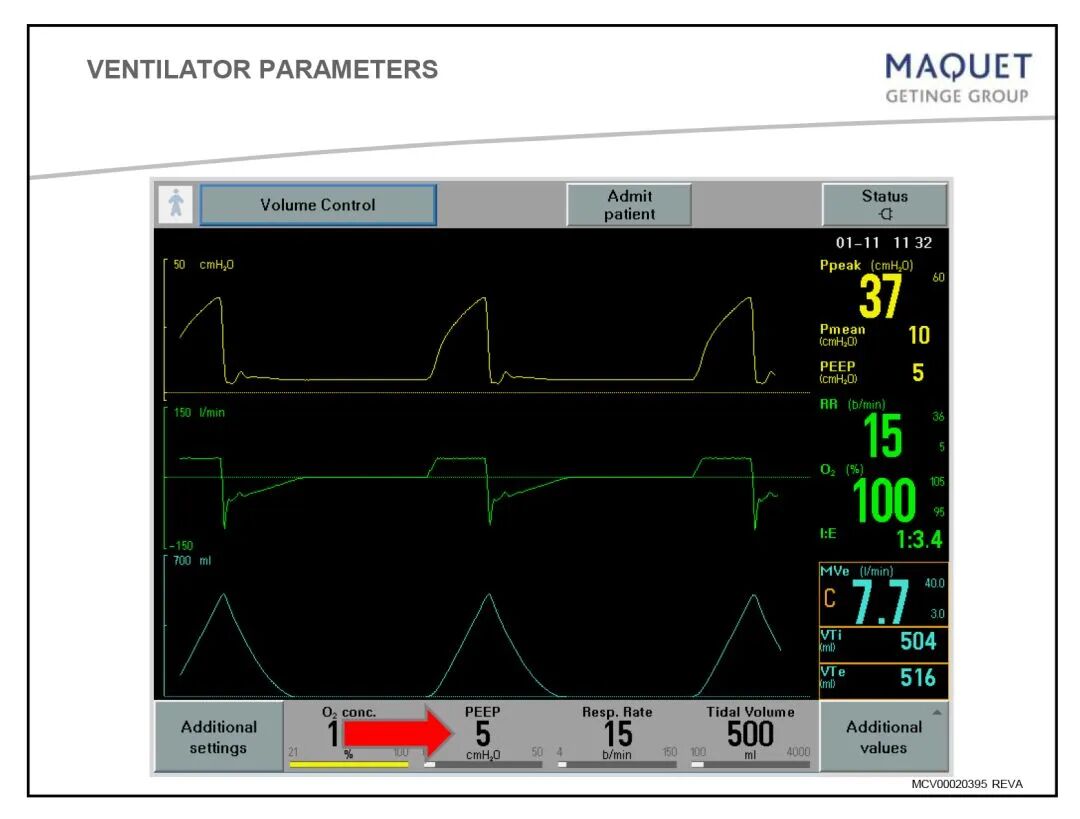 呼吸机呼吸用什么表示「基础篇」呼吸机模式及参数设置，快速上手！呼吸机操作入门，看这篇就够了_https://www.jmylbn.com_新闻资讯_第6张