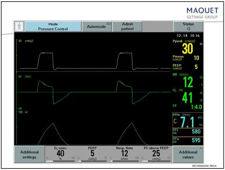 呼吸机呼吸用什么表示「基础篇」呼吸机模式及参数设置，快速上手！呼吸机操作入门，看这篇就够了_https://www.jmylbn.com_新闻资讯_第10张