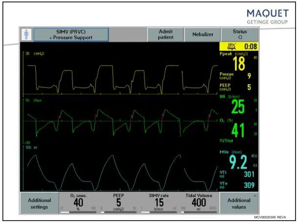 呼吸机呼吸用什么表示「基础篇」呼吸机模式及参数设置，快速上手！呼吸机操作入门，看这篇就够了_https://www.jmylbn.com_新闻资讯_第21张