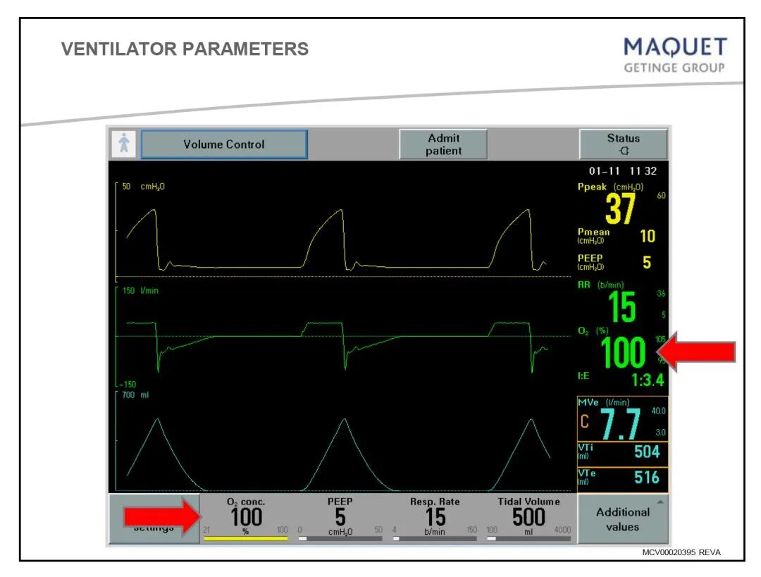 家用呼吸机怎么调节「基础篇」呼吸机模式及参数设置_https://www.jmylbn.com_新闻资讯_第4张