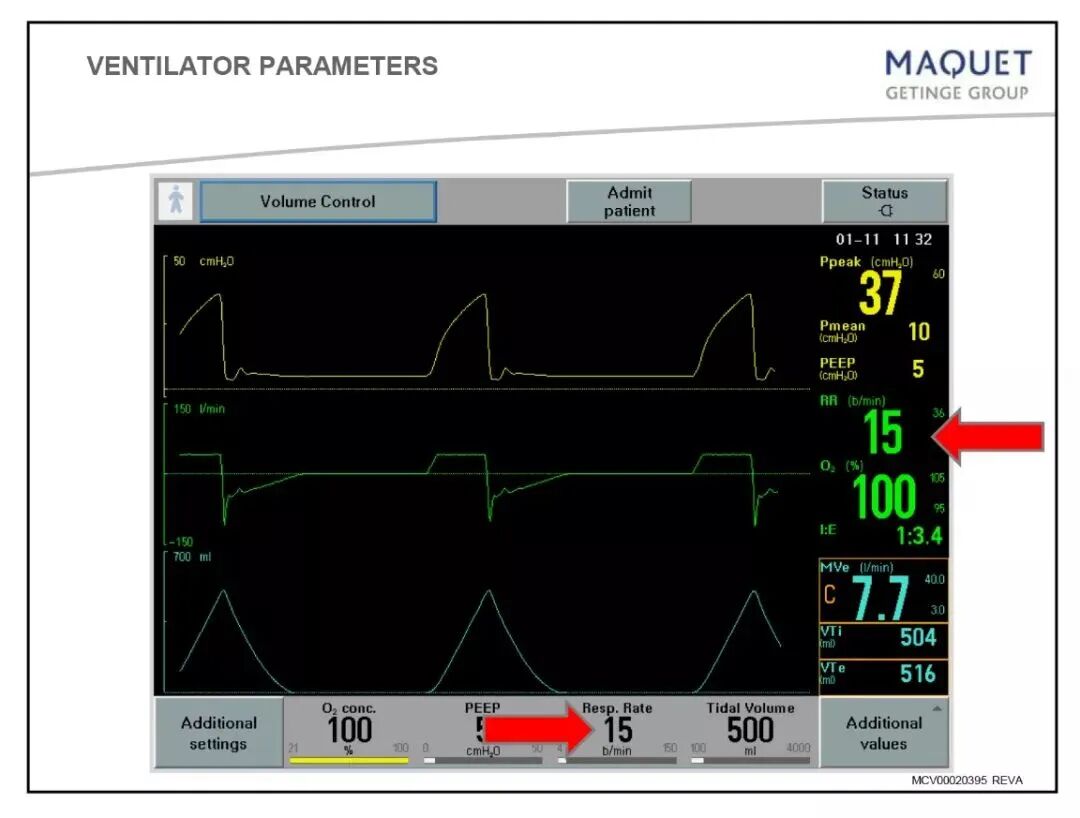 家用呼吸机怎么调节「基础篇」呼吸机模式及参数设置_https://www.jmylbn.com_新闻资讯_第1张