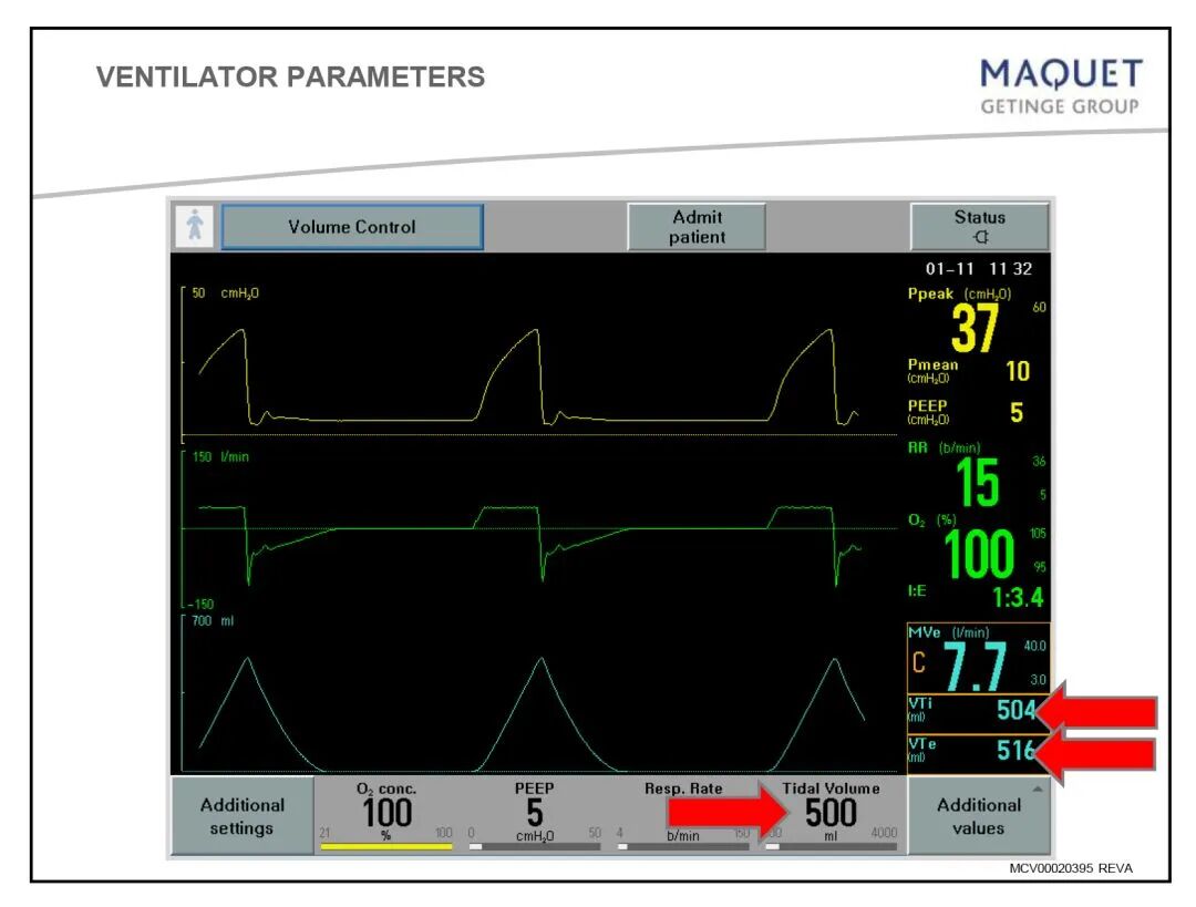 家用呼吸机怎么调节「基础篇」呼吸机模式及参数设置_https://www.jmylbn.com_新闻资讯_第2张