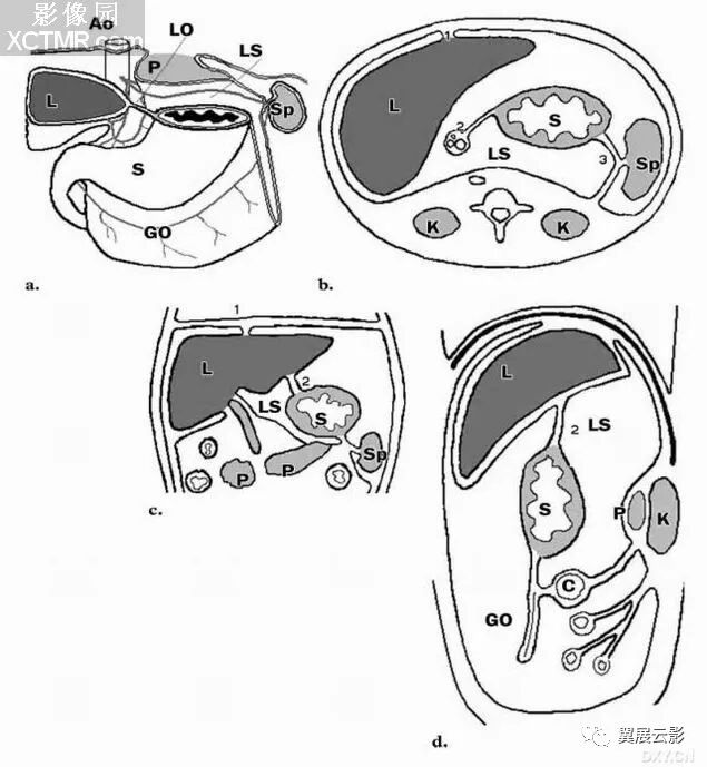 小网膜囊的上隐窝包绕着肝尾状叶,它通过网膜孔与腹膜腔相通,通常将该