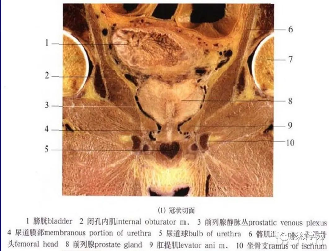 前列腺解剖及mri表現