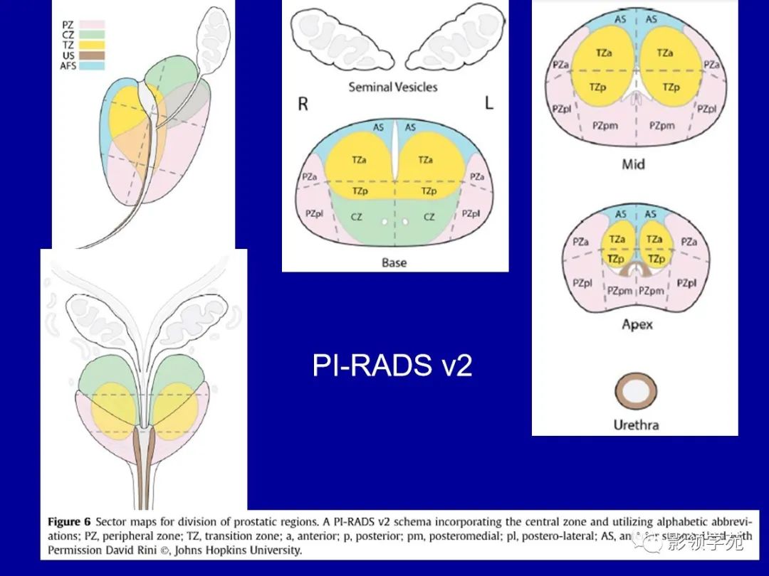 前列腺解剖及mri表現