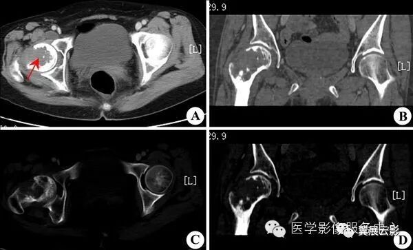 骨科精读150种骨关节影像诊断