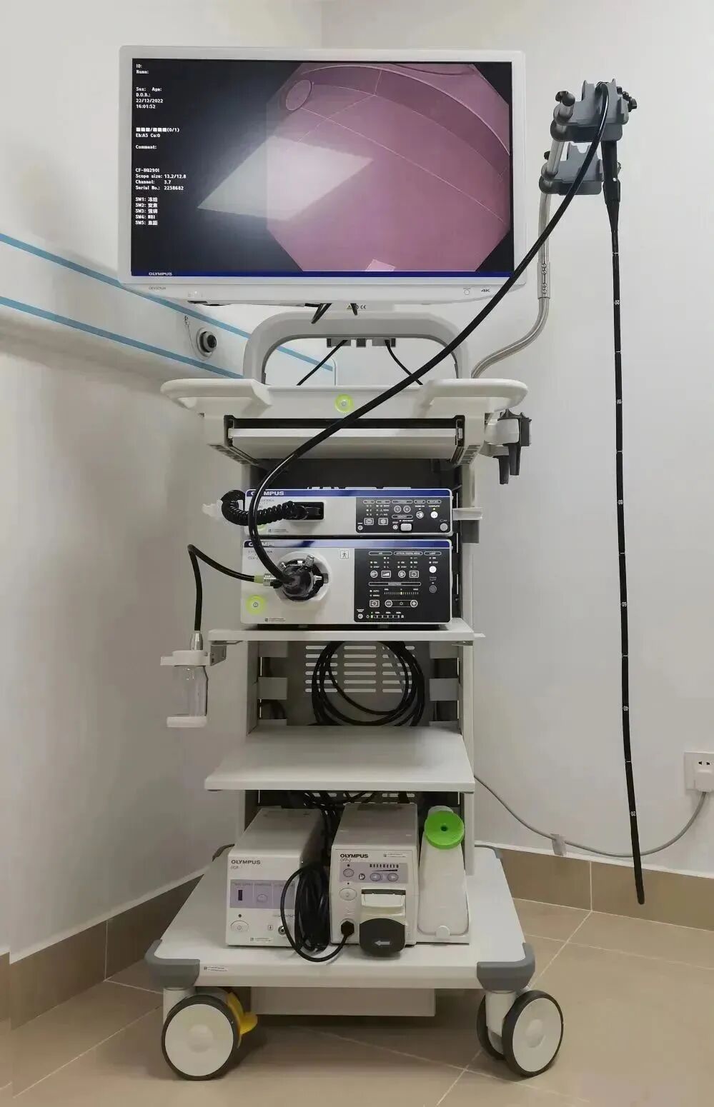 奥林巴斯胃肠镜怎么做全球最先进胃肠镜奥林巴斯290入驻我院！_https://www.jmylbn.com_新闻资讯_第7张