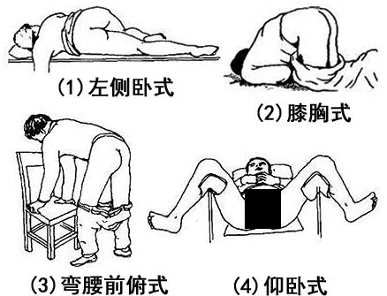 肛拭子采集很必要,但姿势. - 壹读 - 瓦斯阅读