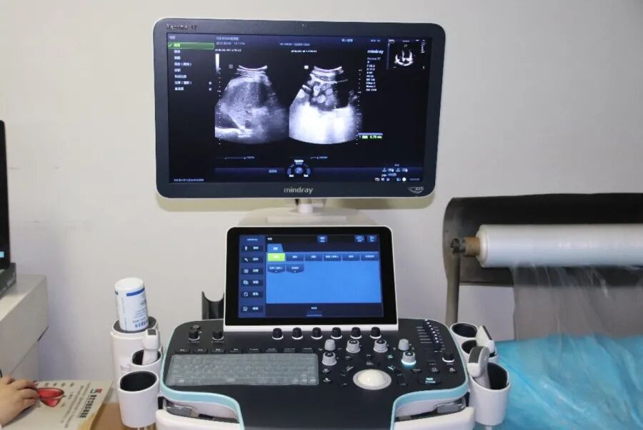 低频脉冲治疗仪怎么用技术展 ｜ 中西医结合的结晶——低频脉冲治疗仪在肝病治疗领域的应用_https://www.jmylbn.com_新闻资讯_第36张