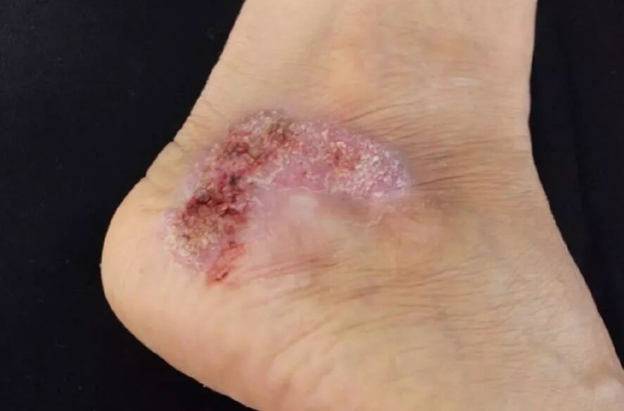              -               - WeMP