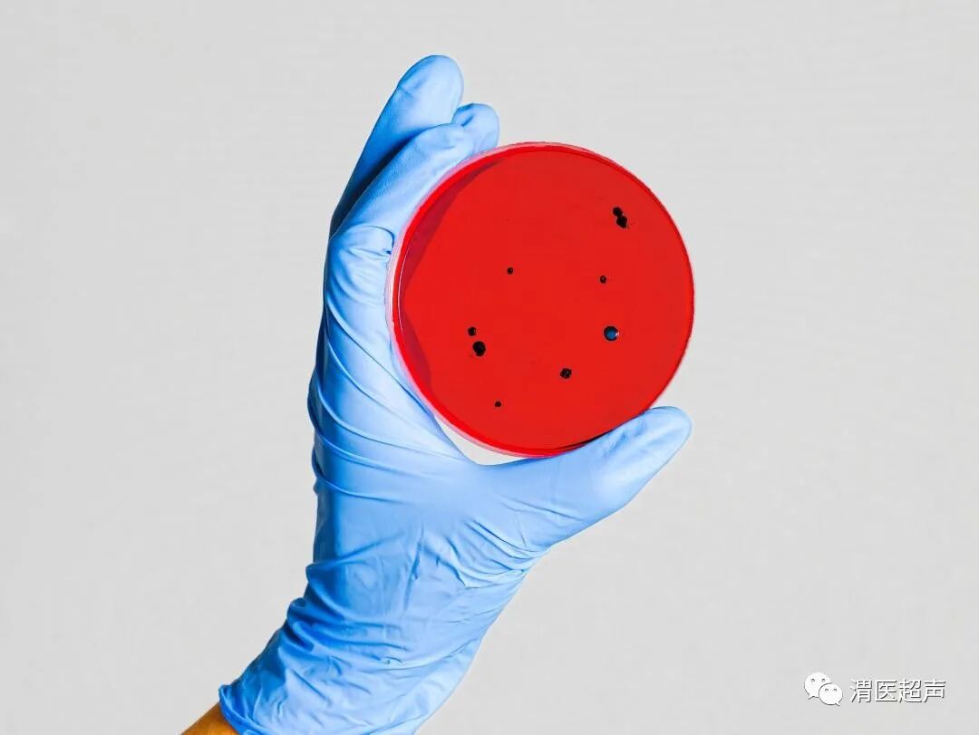 超声探头消毒用什么疫情反复，超声科在工作中如何做好防护？_https://www.jmylbn.com_新闻资讯_第7张
