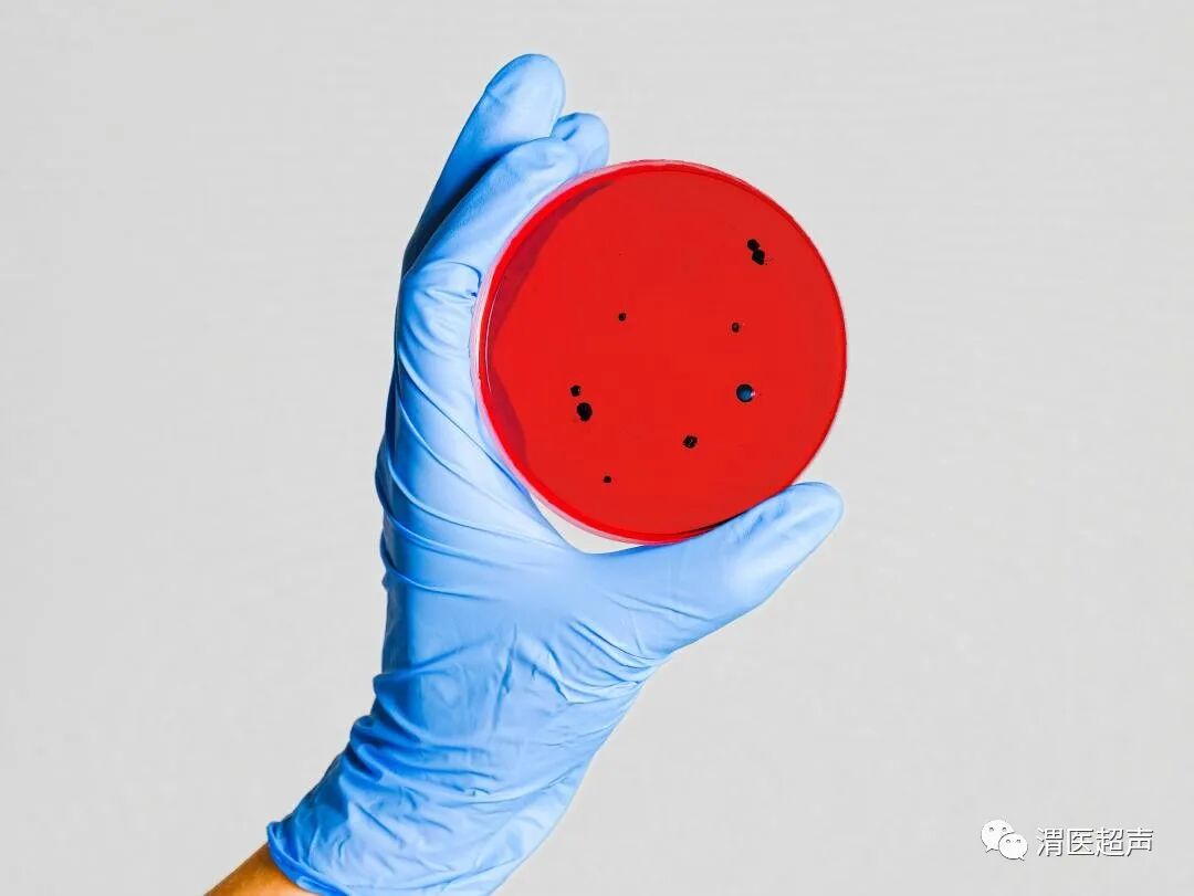 超声探头消毒用什么疫情反复，超声科在工作中如何做好防护？_https://www.jmylbn.com_新闻资讯_第6张