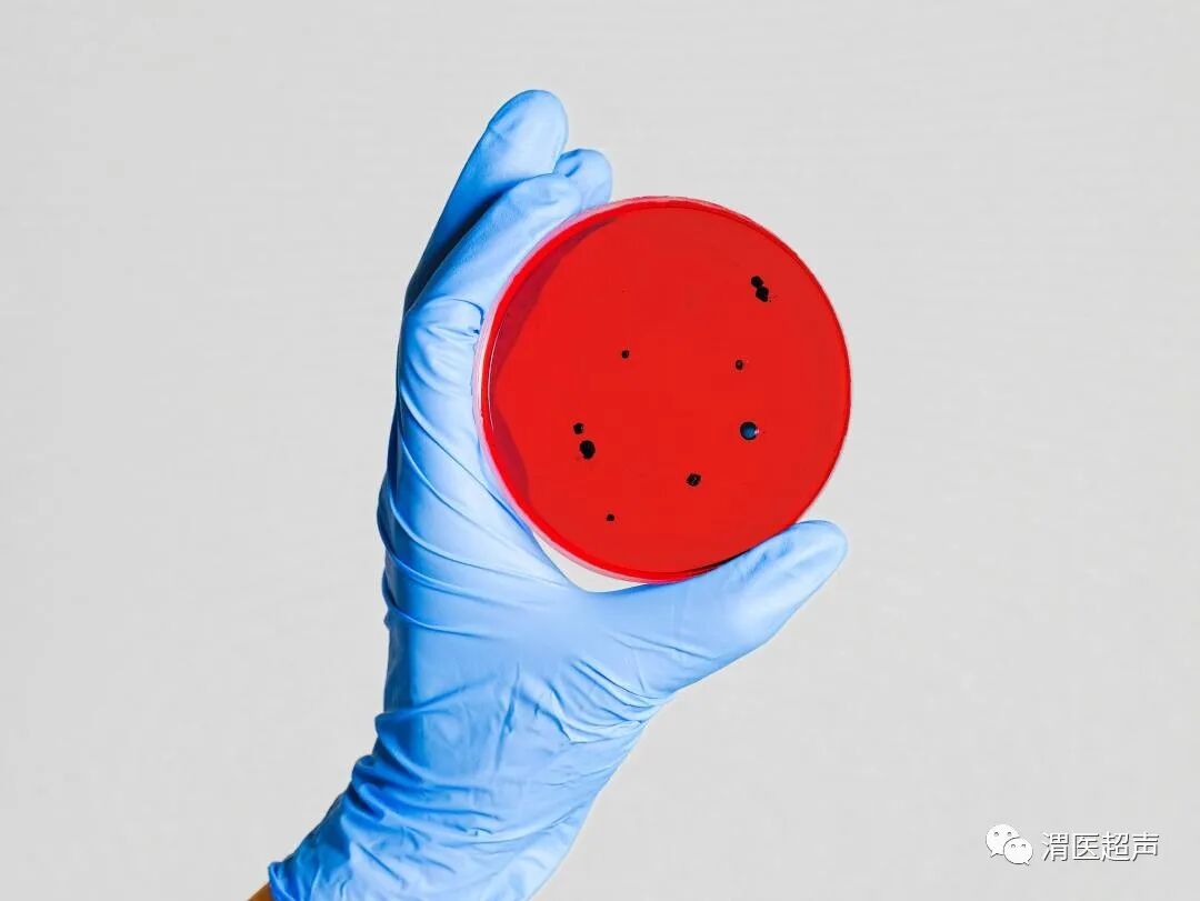 超声探头消毒用什么疫情反复，超声科在工作中如何做好防护？_https://www.jmylbn.com_新闻资讯_第4张