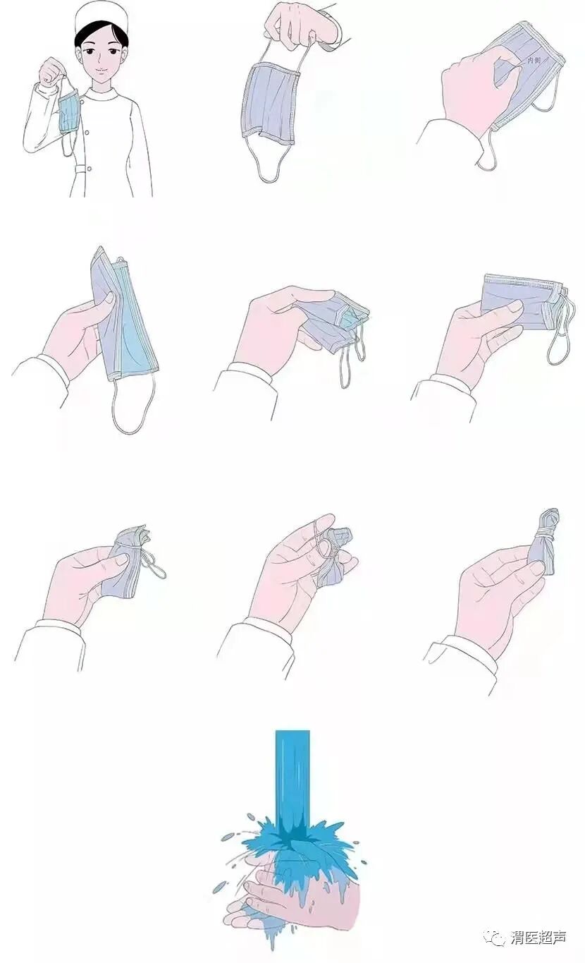 超声探头消毒用什么疫情反复，超声科在工作中如何做好防护？_https://www.jmylbn.com_新闻资讯_第15张