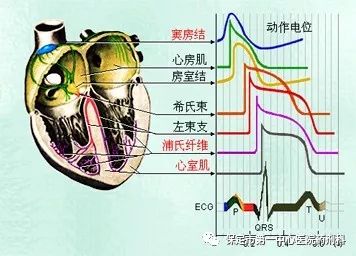 极化液是含葡萄糖、胰岛素、氯化钾的静脉输液组合。能够帮助病态的心肌