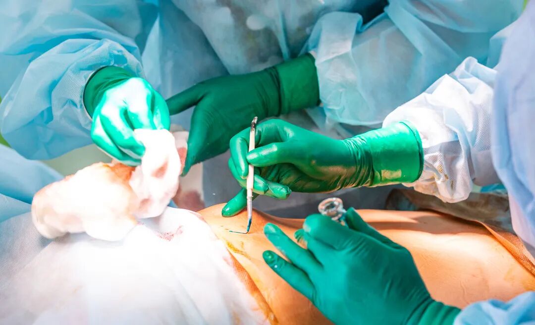 妇科器械盘怎么消毒妇科部位适合使用什么进行消毒？_https://www.jmylbn.com_新闻资讯_第4张