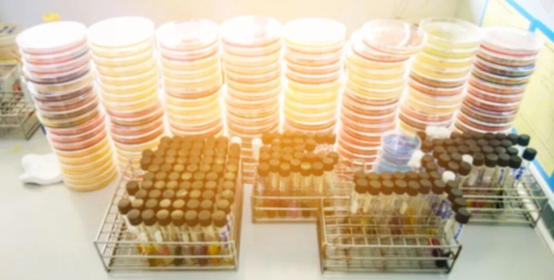 妇科器械盘怎么消毒妇科部位适合使用什么进行消毒？_https://www.jmylbn.com_新闻资讯_第2张