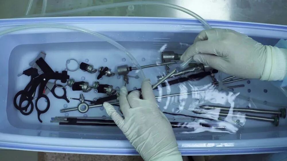 多酶清洗剂怎么使用使用内镜清洗剂时不得不注意的事_https://www.jmylbn.com_新闻资讯_第5张