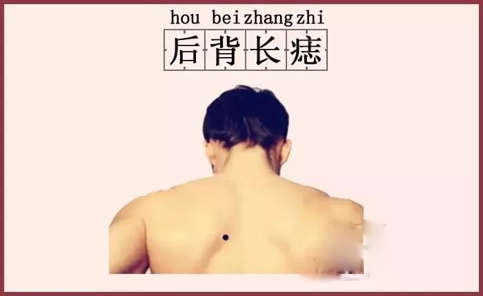 这“4颗痣”一个颗比一颗值钱，千万别点掉！