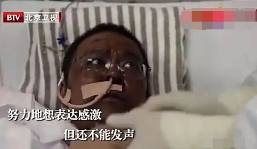 李文亮同事被搶救後變「黑人」，與病毒鬥爭原來如此慘烈…… 健康 第5張