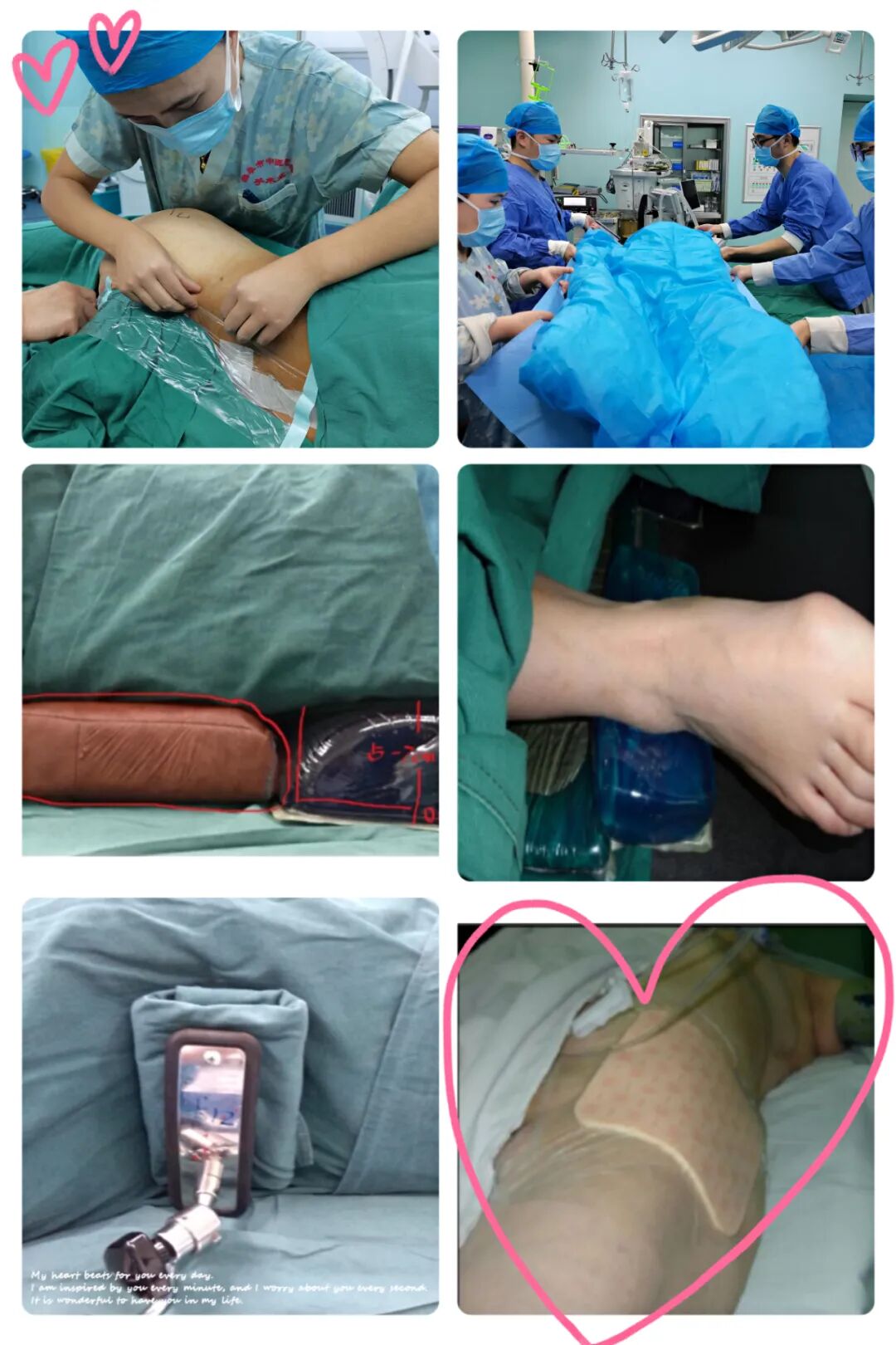 病人滑移垫怎么用这个冬天不太冷，看手术室里那些暖暖的套路......_https://www.jmylbn.com_新闻资讯_第21张