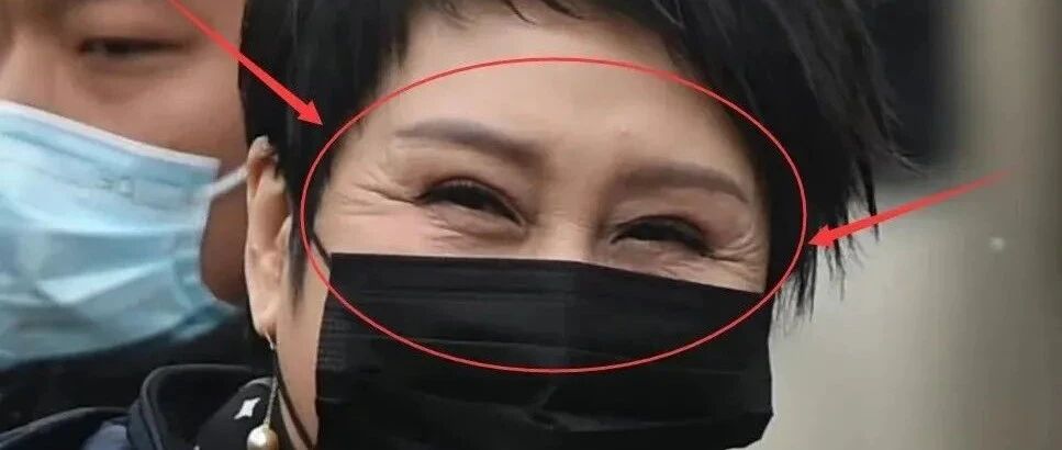 张凯丽春晚彩排被拍，双眼皮不下挂，但眼尾褶皱不自然还特别多！