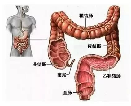 横结肠下垂图片图片