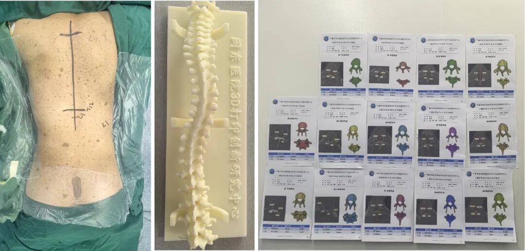 3D打印及手術(shù)規(guī)劃報(bào)告