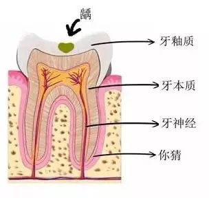 牙齒出現不痛不癢的小黑點時，及時治療才是省錢的開始！ 健康 第3張
