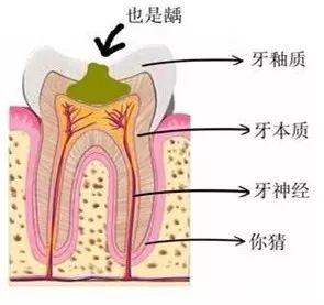 牙齒出現不痛不癢的小黑點時，及時治療才是省錢的開始！ 健康 第5張