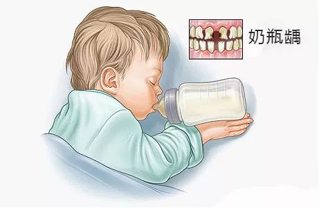 孩子乳牙蛀了不用管，换完牙就好了？这句话坑了多少娃！