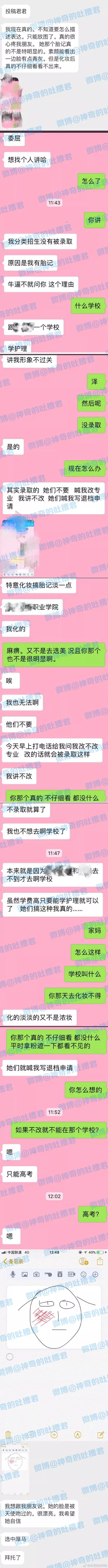 只因右脸有胎记，被报考学校退档了 - 2