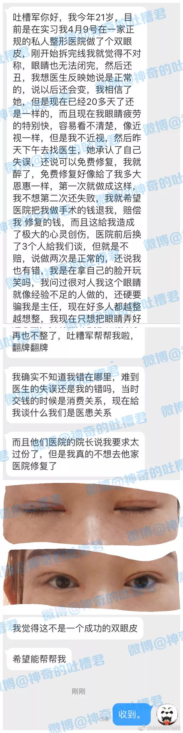 怎么办？？新开的双眼皮，咋越看越古怪......？！ - 2