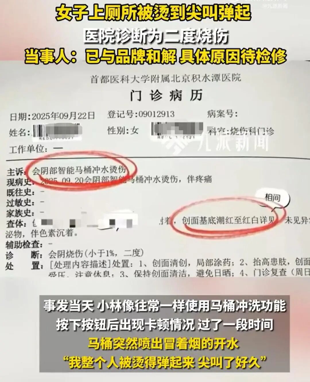 1090元网购智能马桶突发爆炸
