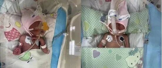 双胞胎命悬一线 父亲含泪抓阄抉择……