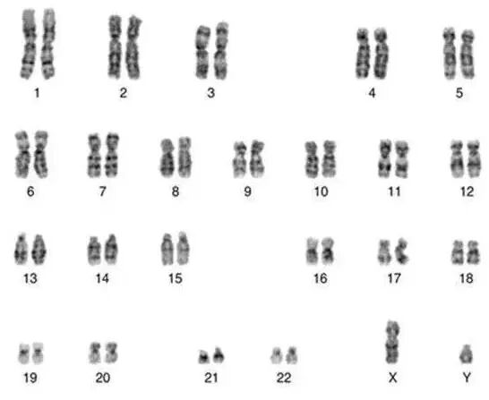 关于狐臭遗传你知多少？